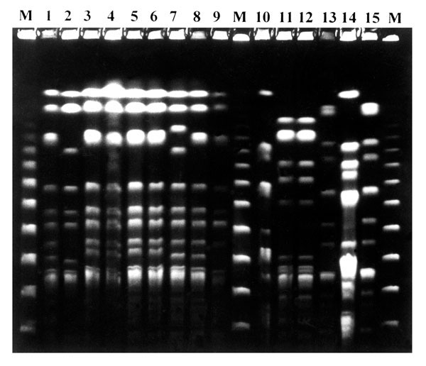 Pulsed-field gel electrophoresis pattern of XbaI-digested genomic DNA of Stenotrophomonas maltophilia isolates from two SM-RE patients. Lanes 1-10 from patient 1 (persistence group): pattern 1a (lanes 1,3-6,8), pattern 1b (ln 7), pattern 1c (lane 9) and pattern 2 (lane 2); lanes 10-15 from patient 5 (variability group): pattern 3 (lane 10), pattern 4 (lane 11,12), pattern 5 (lane 13), pattern 6 (lane 14), pattern 7 (lane 15). Lanes M, bacteriophage lambda standard marker.