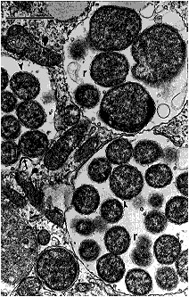 Human monocytic ehrlichiae (Ehrlichia chaffeensis, Sapulpa strain) in host-cell membrane-limited parasitophorous vacuoles (morulae) of a DH82 cell (canine macrophage cell line). Ehrlichial reticulate cells (r) are limited by two membranes. The outer one -- the cell wall membrane -- is usually wavy (arrowheads). One Ehrlichia is dividing by binary fussion (arrow). Bar = 1 µm; magnification, x 18,000. (Courtesy of Vsevolod Popov, University of Texas Medical Branch at Galveston.)