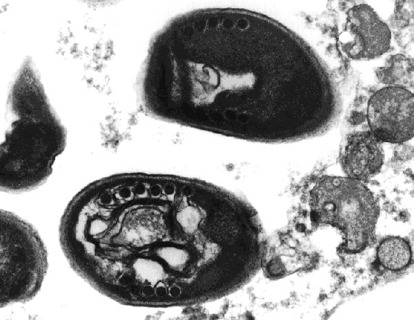 Transmission electron micrograph of an Encephalitozoon intestinalis spore from cell culture showing the polar tube with four to seven coils in single rows, which is typical of the genus Encephalitozoon. Original magnification, x28,500.