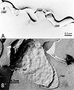 Thumbnail of   Freeze-fracture electron microscopy of Treponema pallidum subsp. pallidum (A), and Escherichia coli (B). Concave  and convex outer membrane (OMF) and inner membrane (IMF) fracture faces.