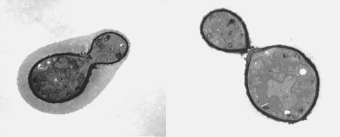 Transmission electron micrograph C. neoformans showing the characteristic polysaccharide capsule.