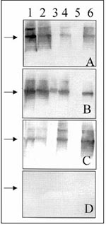 Thumbnail of Western blot assay for detecting IgG antibodies in patient and rodent blood samples. A 1:500 dilution of serum was used to probe Western blots containing equimolar amounts of recombinant-expressed N antigens of various hantaviruses: 1) Bayou; 2) Muleshoe; 3) Puumala; 4) Rio Mamoré; 5) Seoul; and 6) Sin Nombre. Serum samples are directed against specific hantaviruses as verified by reverse transcription-PCR and sequence analyses: (A) patient T/Tx, Bayou virus; (B) Bayou virus-seropos