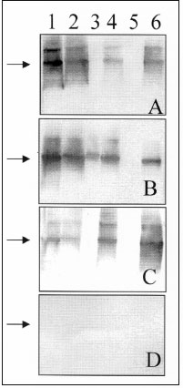 Western blot assay for detecting IgG antibodies in patient and rodent blood samples. A 1:500 dilution of serum was used to probe Western blots containing equimolar amounts of recombinant-expressed N antigens of various hantaviruses: 1) Bayou; 2) Muleshoe; 3) Puumala; 4) Rio Mamoré; 5) Seoul; and 6) Sin Nombre. Serum samples are directed against specific hantaviruses as verified by reverse transcription-PCR and sequence analyses: (A) patient T/Tx, Bayou virus; (B) Bayou virus-seropositive Oryzomy