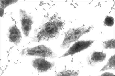 Aggregative pattern of adherence in the HEp-2 assay after 3 hours incubation of bacteria with HEp-2 cells. Note bacteria on the surface of the HEp-2 cells as well as on the glass substratum.