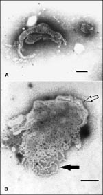 Thumbnail of Transmission electron micrographs of Menangle virus negatively stained with 2% phosphotungstic acid. A. Depicts the pleomorphic nature of the virion; bar=100nm. B. Shows a disrupted virion, the virus envelope with surface projections (hollow arrow) and nucleocapsids (solid arrow); bar=100nm.