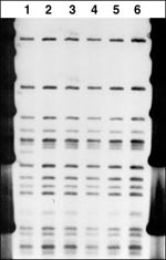 Thumbnail of TBN12 restriction fragment length polymorphism results. Lane 1, elephant isolate (died August 6, 1996); Lane 2, elephant isolate (died 1994); Lane 3, living elephant trunk culture (October 1996); Lane 4, elephant lung tissue isolate (died August 3, 1996); Lane 5, elephant lymph node tissue isolate (died August 3, 1996); Lane 6, human sputum isolate (September 1996). Provided by State of Michigan Community Public Health Agency.