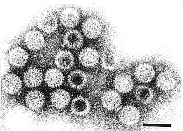 Rotavirus particles visualized by immune electron microscopy in stool filtrate from child with acute gastroenteritis. 70-nm particles possess distinctive double-shelled outer capsid. Bar = 100 nm.