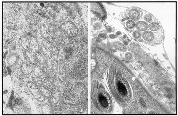Wolbachia-like organisms in insect reproductive tissues.