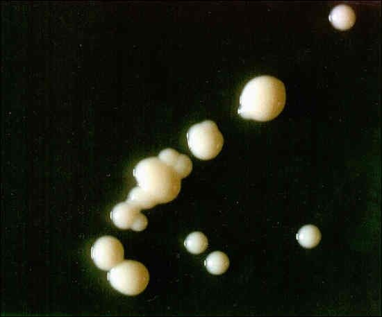 Colony morphology of strain NZM 217/94 on Middlebrook 7H10 agar.