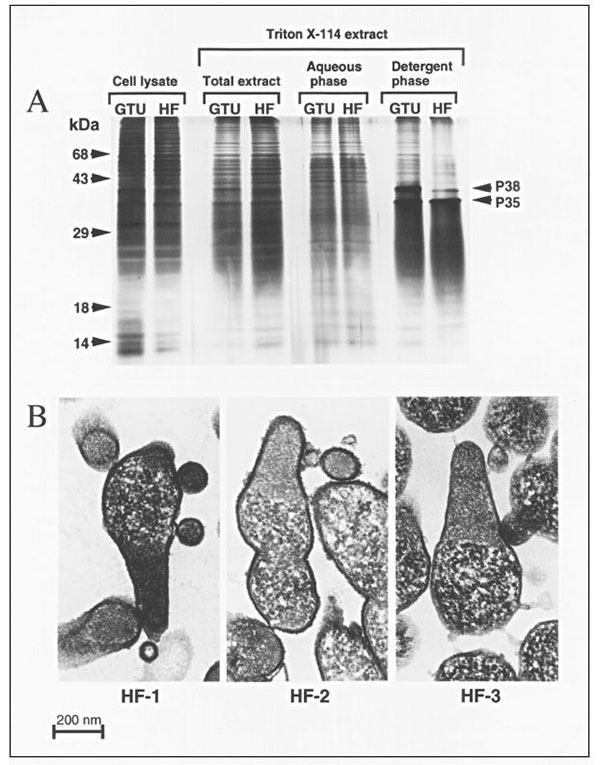 HF isolates belong to the species Mycoplasma penetrans. A. Comparison of protein patterns from the type strain of M. penetrans and the isolate HF-1. Mycoplasma cells were directly lysed with SDS (cell lysate), or antigens were extracted with the neutral detergent Triton X-114 (total extract). Antigens were further separated after partitioning between the aqueous and detergent phases. The two mycoplasmas compared are the M. penetrans type strain GTU-54-6A1 (GTU) and the isolate HF. B. Ultrastruct