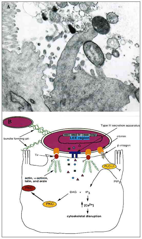A. Transmission electron micrograph of an A/E lesion formed by rabbit enteropathogenic Escherichia coli (EPEC) infecting rabbit intestinal epithelial cells (micrograph provided by Dr. Ursula Heczko, Biotechnology Laboratory, University of British Columbia). B. Effects of EPEC infection on host intestinal epithelial cells. EPEC initially adheres to the host cell by its bundle-forming pili, which also mediate bacterial aggregation. Following initial attachment, EPEC secretes several virulence fact