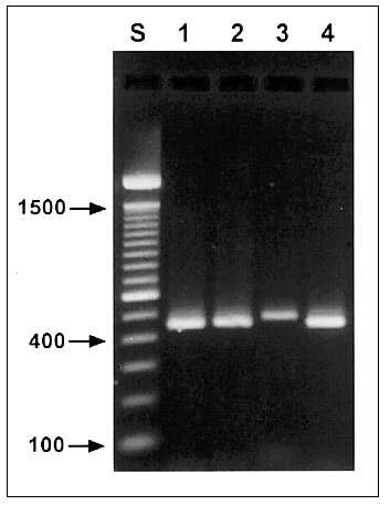 Agarose gel (2%) visualization of diagnostic polymerase chain reaction products of four Cryptosporidium genotypes. Lane S, standard 100-bp ladder; lane 1, patient 53, zoonotic genotype 2; lane 2, patient 119, Cryptosporidium sp. (zoonotic, canine genotype); lane 3, patient 84, C. felis (zoonotic, feline genotype); lane 4, patient 75, anthroponotic genotype 1.