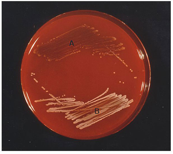 Staphylococcus aureus small colony variants (A) and S. aureus with a normal phenotype (B) cultured on sheep blood agar after 24 hours of incubation at 35°C. Staphylococci were identified by conventional methods (6) and with the ID 32 Staph system (bioMérieux, Marcy-L'Etoile, France) following the instructions of the manufacturer. The tube-coagulase test was read after 24 hours. S. aureus isolates were characterized as small colony variants as described before (7-8). Auxotrophic requirements were
