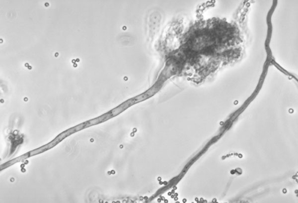 Conidiophore of Aspergillus fumigatus. Image courtesy of Libero Ajello, Centers for Disease Control and Prevention.