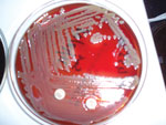 Thumbnail of Six-day-old blood agar growth of Elizabethkingia meningioseptica with 5 μg vancomycin (with zone of clearing) and 10 μg colistin disks. Source: Dr. Saptarshi via Wikimedia Commons