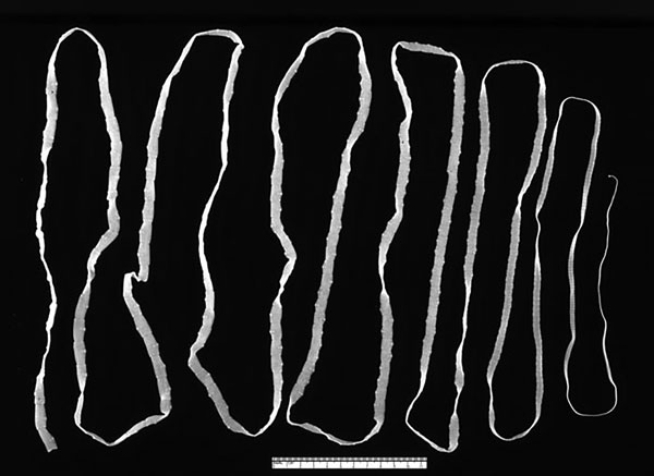 Ad Taenia saginata tapeworm. Photo CDC/1986.