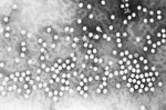 Thumbnail of This electron micrograph depicts a number of parvovirus H-1 virions of the Parvoviridae family of DNA viruses. Photo CDC/ R. Regnery; E. L. Palmer, 1981.