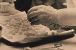 Thumbnail of This historic 1975 photograph shows a laboratory technician preparing doses of polio vaccine by placing a liquid droplet of the vaccine upon each of these sugar cubes, which would subsequently be ingested orally by each recipient. Photo: Public Health Image Library, CDC, 1975