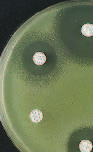 Antimicrobial Drug Resistance: Prediction Is Very Difficult, Especially about the Future