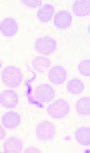 African Trypanosomiasis Gambiense, Italy
