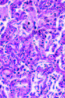 Influenza A H5N1 Replication Sites in Humans