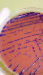 Chromobacterium violaceum in Siblings, Brazil