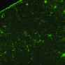 Rickettsia felis infection, Tunisia