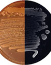  Nematode Symbiont for Photorhabdus asymbiotica