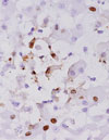 Fatal Avian Influenza A H5N1 in a Dog