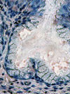 Human Metapneumovirus in Turkey Poults