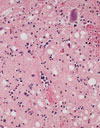 Spongiform Encephalopathy in a Miniature Zebu