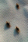 Bartonella quintana Characteristics and Clinical Management