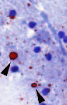 Evaluation of a Direct, Rapid Immunohistochemical Test for Rabies Diagnosis
