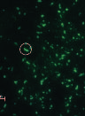 Pneumonic Plague Cluster, Uganda, 2004