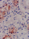 Domestic Ducks and H5N1 Influenza Epidemic, Thailand