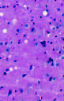 Transmission of New Bovine Prion to Mice