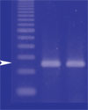 Echinococcus multilocularis in Dogs, Japan