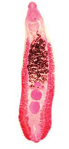 Echinostoma revolutum Infection in Children, Pursat Province, Cambodia