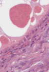  Tembusu Virus in Ducks, China