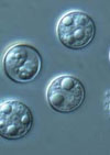  Prevalence and Molecular Characterization of Cyclospora cayetanensis, Henan, China