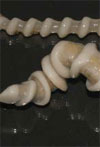 Transmission of Armillifer armillatus Ova at Snake Farm, The Gambia, West Africa