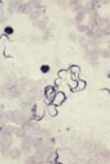 Multiorgan Dysfunction Caused by Travel-associated African Trypanosomiasis