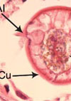 <em>Baylisascaris procyonis</em> Infection in Elderly Person, British Columbia, Canada