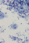 Pigs as Natural Hosts of <em>Dientamoeba fragilis</em> Genotypes Found in Humans