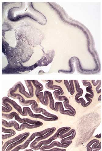BSE-associated Prion-Amyloid Cardiomyopathy in Primates
