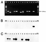 Thumbnail of Results of ethidium bromide staining (panel A) and corresponding Southern hybridization (panels B and C) of RT-PCR products of eight calf herd (CH) samples (A) M= molecular mass marker, lane 1: CH124; lane 2: CH125; lane 3: water; lane 4: CH126; lane 5: CH138; lane 6: water; lane 7: CH139; lane 8: CH145; lane 9: water; lane 10: CH156; lane 11: CH176; lane 12: water; lane 13: human NLV positive control (5); lane 14: water. For Southern blot hybridizations, a set of probes used to det