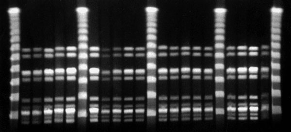 Pulsed-field gel electrophoresis of group A streptococci causing clinical infection in 19 drug users, Berne, Switzerland.