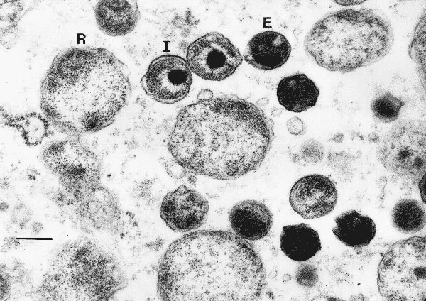 Transmission electron micrograph of chlamydial particles in liver from a captive African clawed frog (Xenopus tropicalis). Note the reticulate bodies (R), intermediate bodies (I), and highly condensed elementary bodies (E). Bar, 270 nm.