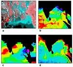 Thumbnail of Datasets used to model the temporal patterns of cholera outbreaks in Bangladesh. a) Advanced Very High Resolution Radiometer (AVHRR) satellite image showing the mouth of the Ganges River and the Bay of Bengal. Vegetation is shown in shades of red and water in shades of blue. The spatial resolution of these data is 1.1 km. b) Sea surface temperature data, derived from AVHRR thermal bands. Temperatures range from low (purple) to high (red). c) Sea surface height data, derived from TOP