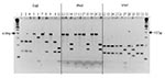 Thumbnail of Polymerase chain reaction/restriction fragment length polymorphism of the citrate synthase gene of isolates from cattle, deer, and elk, with TaqI, HhaI, and MseI endonucleases. Lanes 1 and 32, standard 100-bp molecular ladder; lanes 2, 12, and 22, cattle isolate; lanes 3 to 7, 13 to 17, and 23 to 27, deer isolates; lanes 8 to 10, 18 to 20, and 28 to 30, elk isolates; lanes 11, 21, and 31, B. henselae strain.